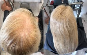 hair transformation mesh