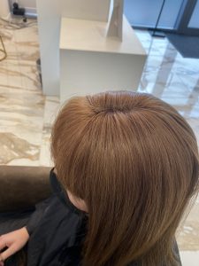 crown after mesh integration crown after mesh integration