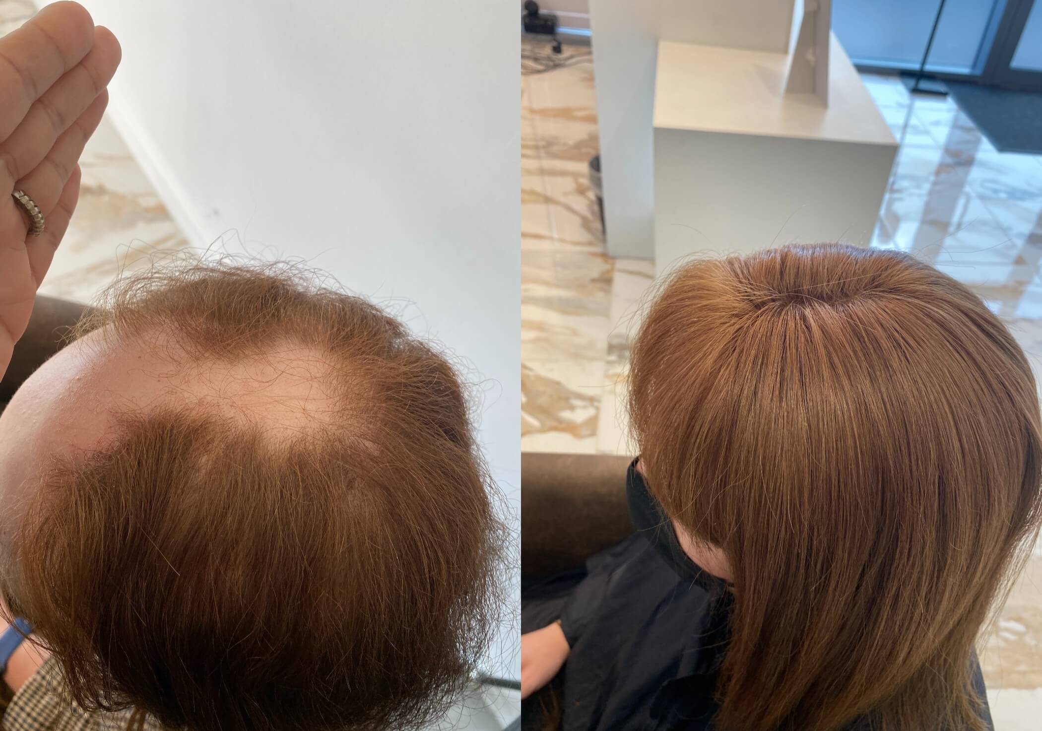 A Guide On The Best Extensions For Thin Hair A Guide On The Best Extensions For Thin Hair